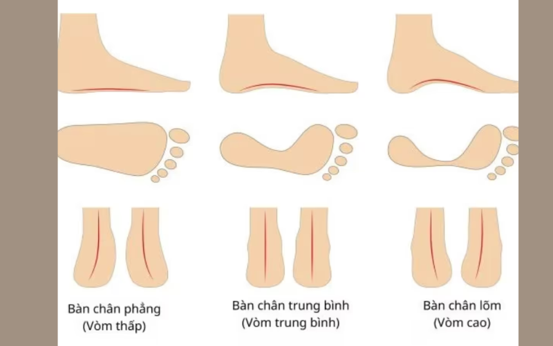Giày nhảy Zumba: Đặc điểm, cách chọn và các mẫu giày được ưa chuộng 46 Chọn giày nhảy Zumba theo cấu trúc bàn chân