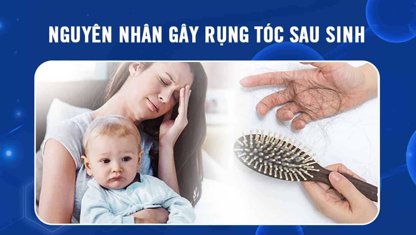 Chế độ dinh dưỡng thiếu sắt, vitamin B3 hay tâm lý căng thẳng là nguyên nhân khiến bạn bị rụng tóc sau sinh