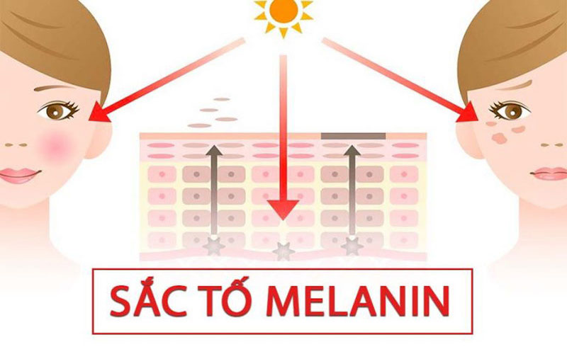 Sắc tố melanin là gì? Cách tăng sắc tố melanin trong cơ thể